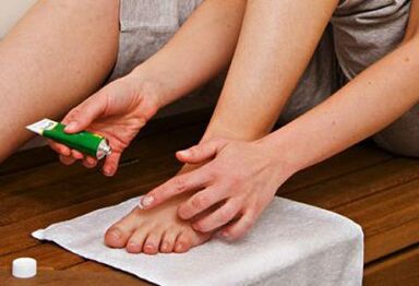 Aplicación de un ungüento para tratar hongos en las uñas de los pies